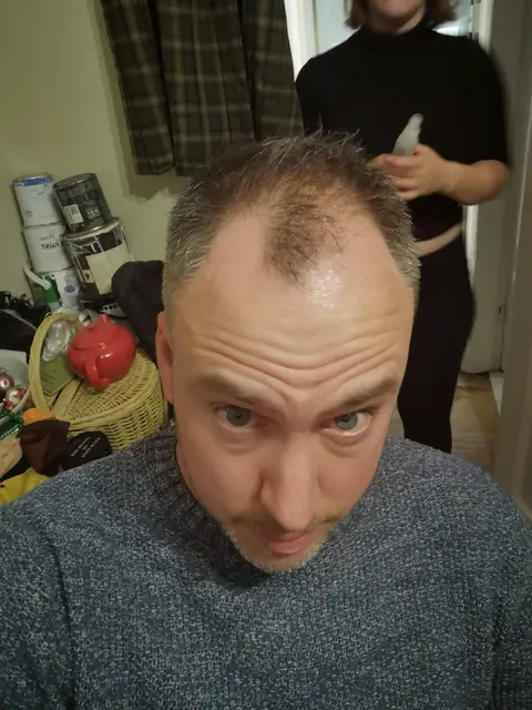 I Tried A Hair Loss Instagram Advert from Gofybr